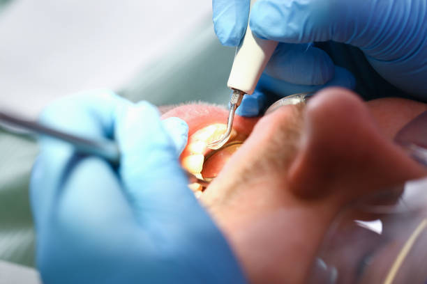 Best Cracked Tooth Emergency Dentist  in Brazoria, TX