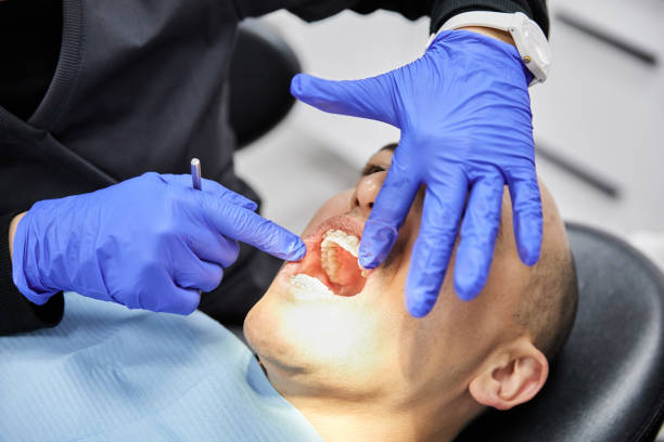 Emergency Gum Pain Relief in TX